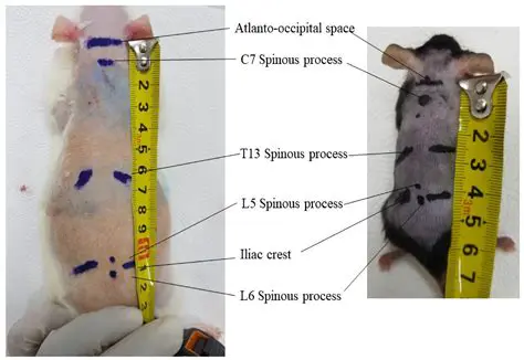 Anatomy of the Intrathecal Space