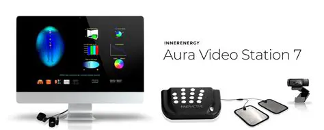 Benefits of Aura Video Station