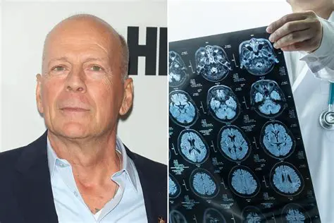 Bruce Willis Latest News Today: A Look at His Life and Legacy Amidst Health Challenges