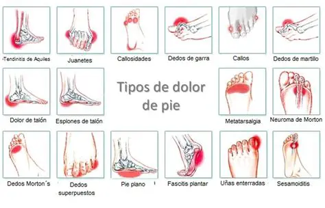 Dolor en la parte superior del pie