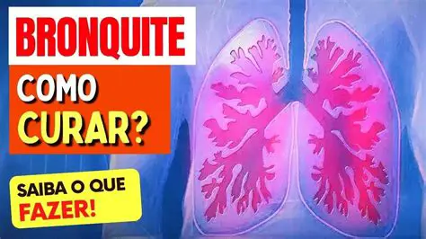 Perguntas frequentes sobre a bronquite